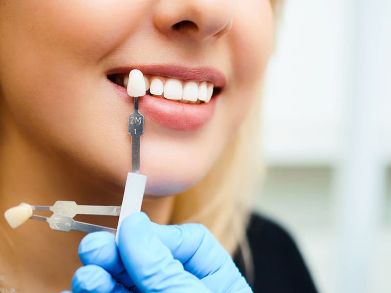 Holding up guide to check whiteness of woman's teeth