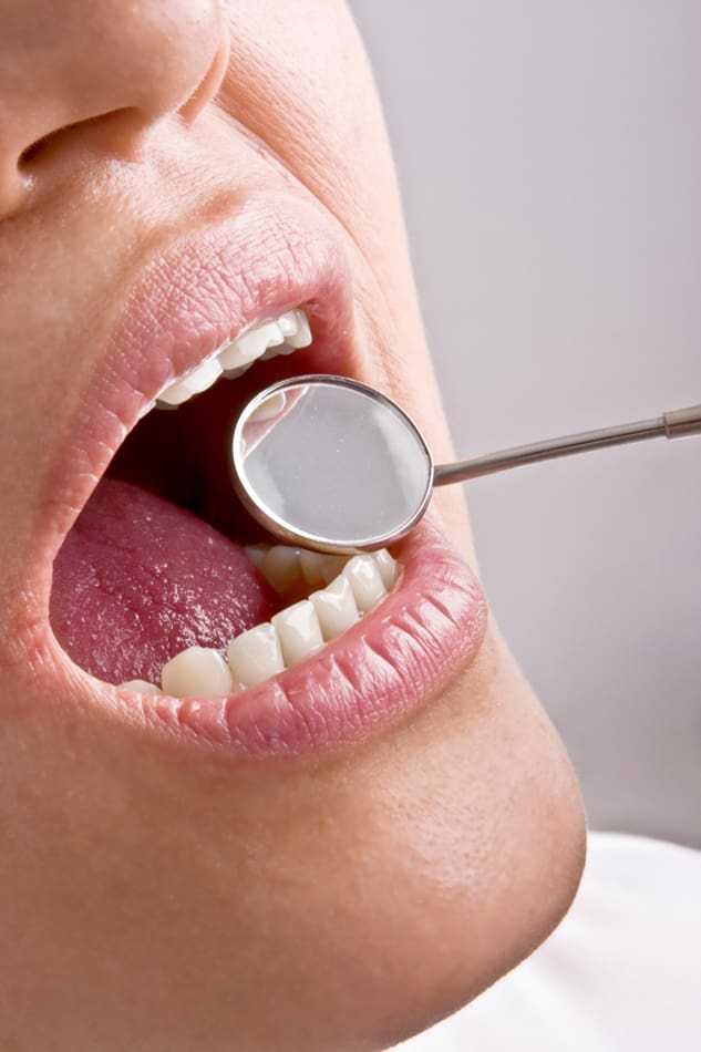 Close up mouth examination